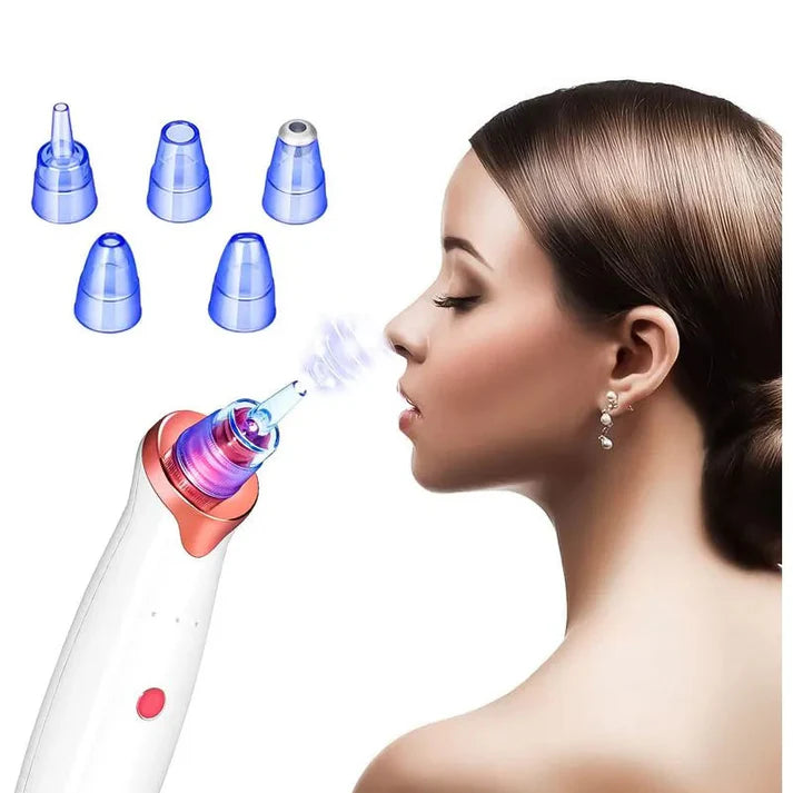 Extractor Profesional de Puntos Negros y Espinillas